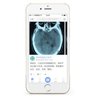 醫(yī)療影像APP開發(fā) 提供有效治療方案