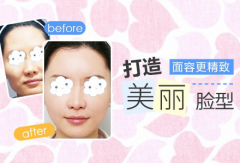 醫(yī)美app軟件開(kāi)發(fā)該這樣解決問(wèn)題 
